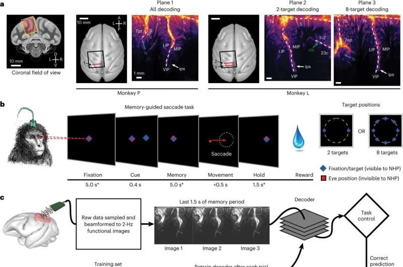 Gestala Unveils Groundbreaking Ultrasound Brain Interface, Challenging Invasive BCI Dominance